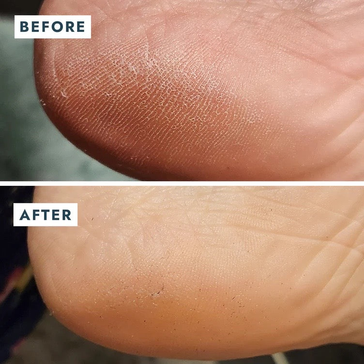 HEEL REPAIR DUO
